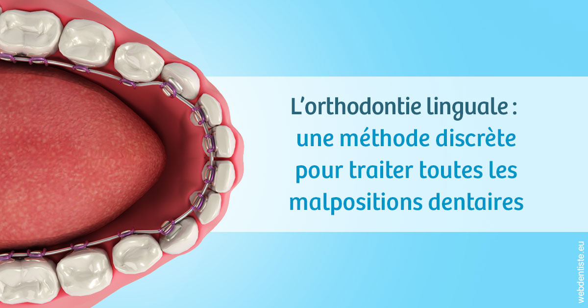 https://www.orthodontie-monthey.ch/L'orthodontie linguale 1