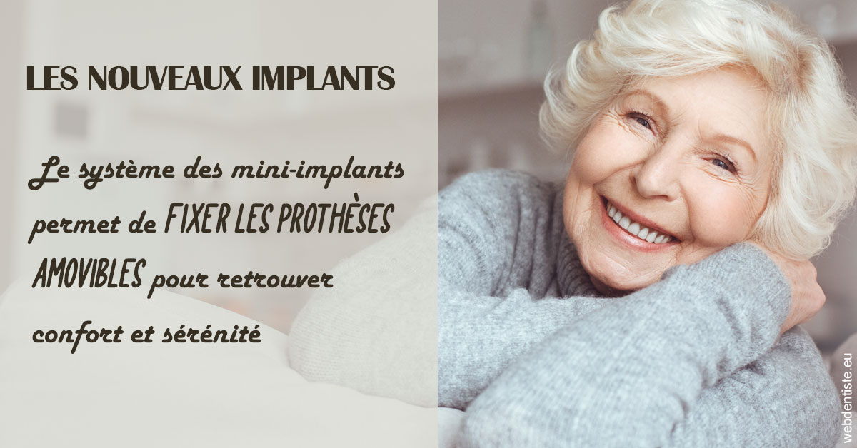 https://www.orthodontie-monthey.ch/Les nouveaux implants 1