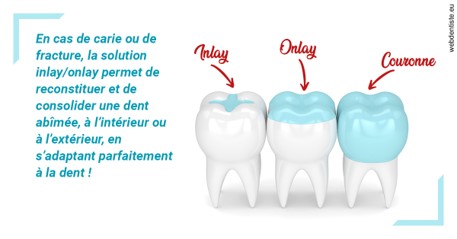 https://www.orthodontie-monthey.ch/L'INLAY ou l'ONLAY