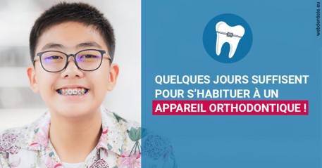 https://www.orthodontie-monthey.ch/L'appareil orthodontique