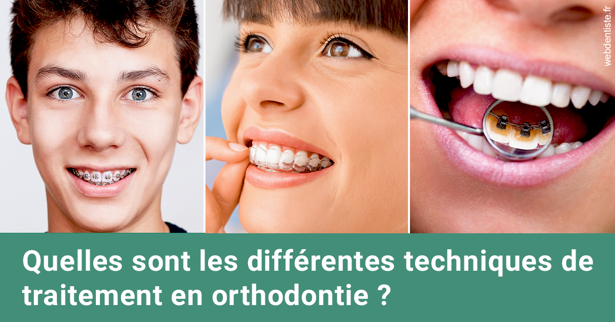 https://www.orthodontie-monthey.ch/Les différentes techniques de traitement 2