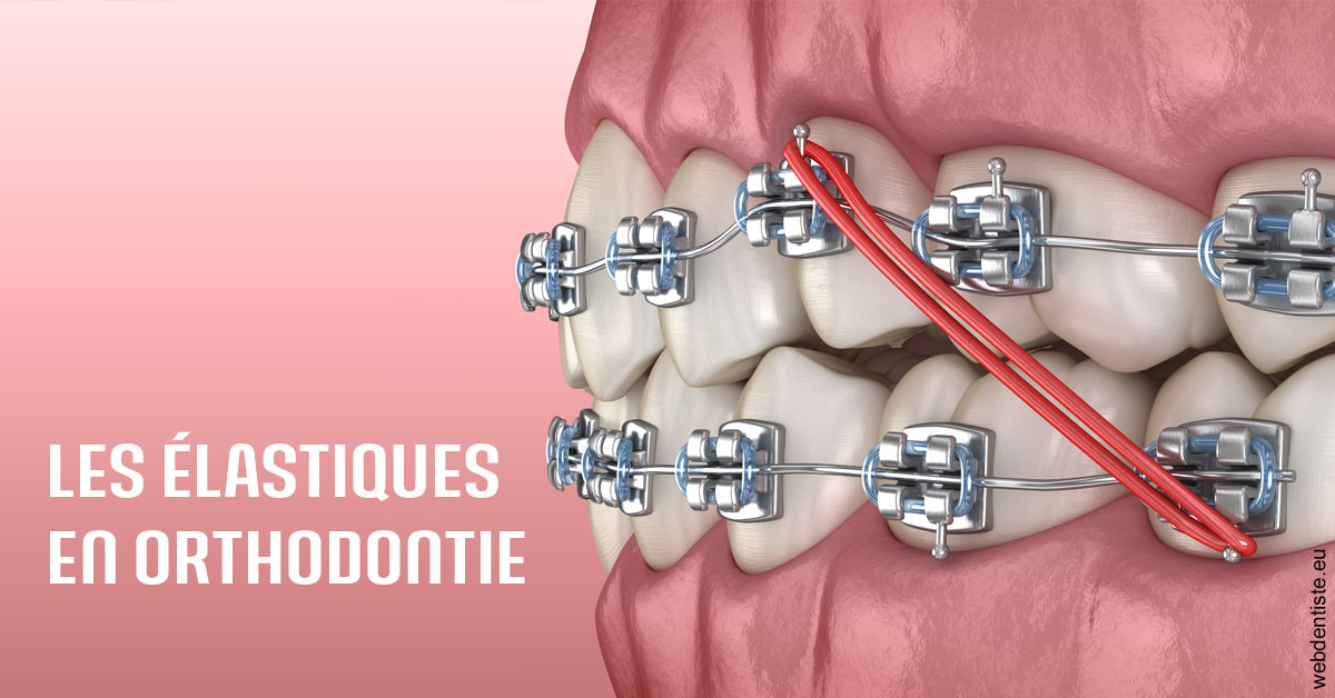 https://www.orthodontie-monthey.ch/Elastiques orthodontie 2